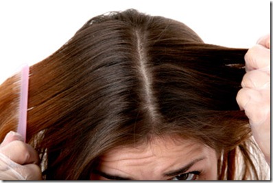 Remedios Caseros para el cabello Grasoso y con Caspa1_thumb[1]