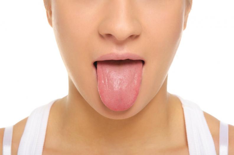 5-causas-de-las-ulceras-en-la-lengua